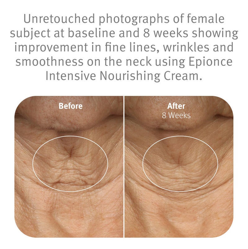 Epionce Intensive Nourishing Cream - Rich Anti-Aging Moisturizer for Face, Neck & Décolletage | Ceramides, Glycerin & Squalene | Targets Fine Lines, Dark Spots & Dryness | Dermatologist Skincare - Image 4